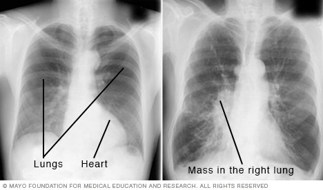 x-ray picture outlining arteries